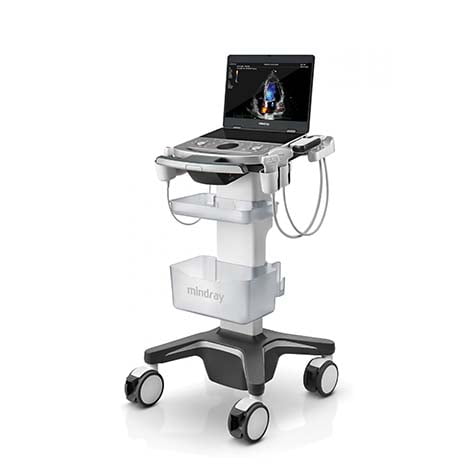 ultrasound machine